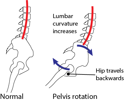 Illustration of pelvic rotation